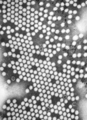 Poliovirus electron micrograph