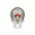 Thalamotomy