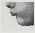 Mentalis