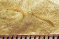 Threadworm (Enterobius vermicularis)