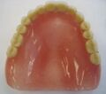 Occlusal view of a denture