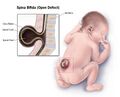 Drugs in pregnancy