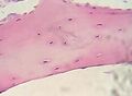 Cartilage