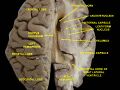 Lateralization of brain function