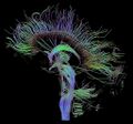 Sagittal view of brain fibers using DTI