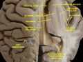 Lateralization of brain function