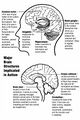 Causes of autism