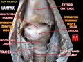 Detailed image of the larynx.
