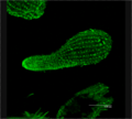 Tetrachimena Beta Tubulin