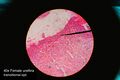 Female Urethra Histology