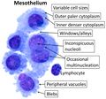 Cytology of normal mesothelium
