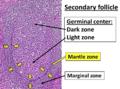 Dark, light, mantle, and marginal zones of a secondary follicle