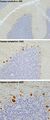PCP4 immunohistochemistry in human cerebellum