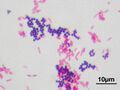 Gram stain showing Gram-positive bacteria