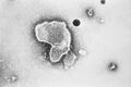 Respiratory Syncytial Virus (RSV) EM PHIL 2175 lores