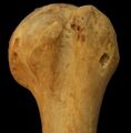 Anterior head of left humerus