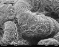 Glomerulum of mouse kidney in Scanning Electron Microscope, magnification 5,000x