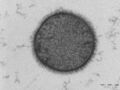 Lipid bilayer