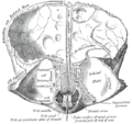 Orbital part of frontal bone