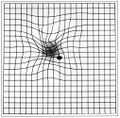 Micropsia