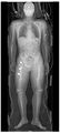 Projectional_radiography