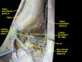Tibialis posterior muscle