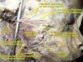 Cervical branch of the facial nerve