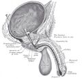 Spanner Stent In Situ