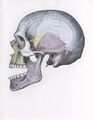 Anterior dislocation of jaw