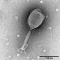 Transmission electron micrograph of Enterobacteria phage T2
