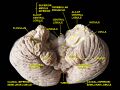 Central lobule