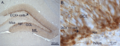 Doublecortin expression in the subgranular zone