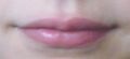 Mouth