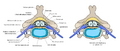Disc herniation