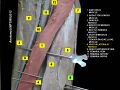 Vastus lateralis muscle dissection