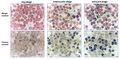 Blood smear