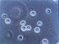Bacteriuria pyuria