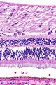Retina -- high magnification