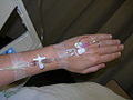 Intravenous therapy
