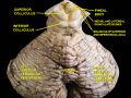 Cerebellar vermis
