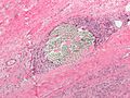 Suture micrograph