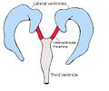 Interventricular foramina (neuroanatomy)