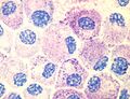 Histamine