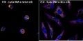 Multiplex ViewRNA FISH Assay in Jurkat and HeLa cells