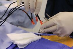 Pain Doctor Radiofrequency Ablation Procedure
