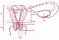 Illustration of ICD-O codes related to cervical cancer