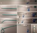 Pigtail catheter settings