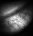 Diagram of Meibomian glands