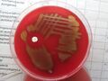 Streptococcus pneumoniae