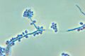 Conidiophores and conidia of the fungus Sporothrix schenckii